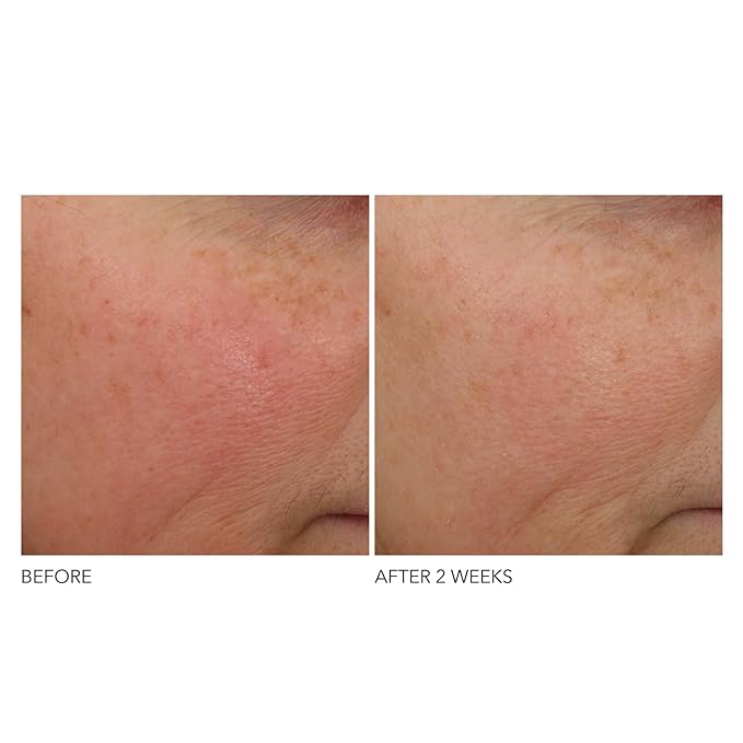 Dr Dennis Gross Advanced Retinol + Ferulic Overnight Wrinkle Treatment: Visibly Firm, Restore Hydration & Reduce the Look of Wrinkles, 1 oz