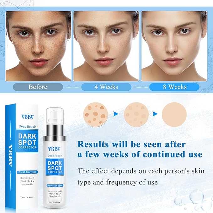 Dark Spot Remover for Face and Body, Dark Spot Corrector, Age Spot Sun Spot Freckles Dark Spot Remover, Melasma Treatment for Face, Advanced Skin Care Cream for Women and Men